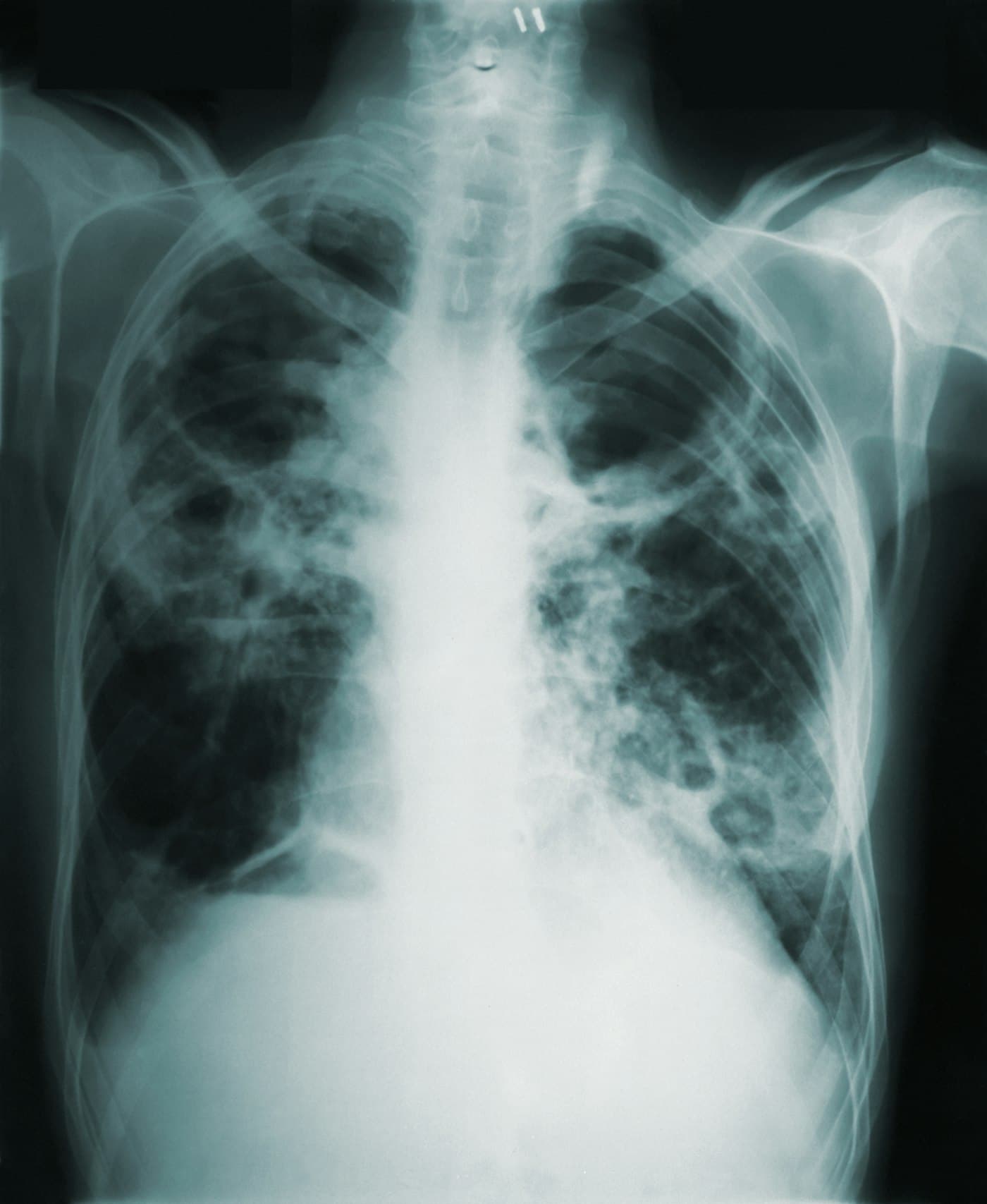 AI Medical Image Analysis